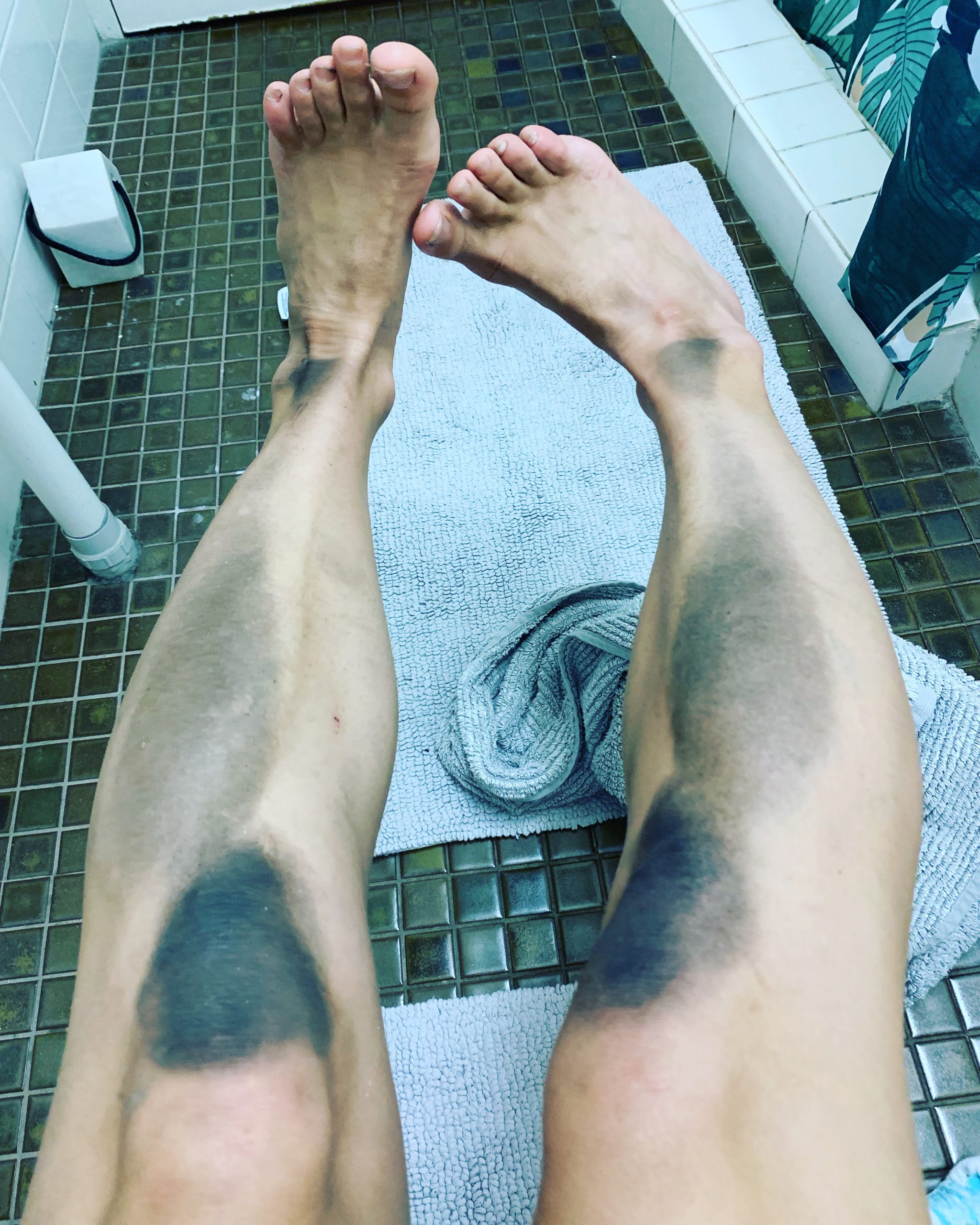 Set of dirty legs